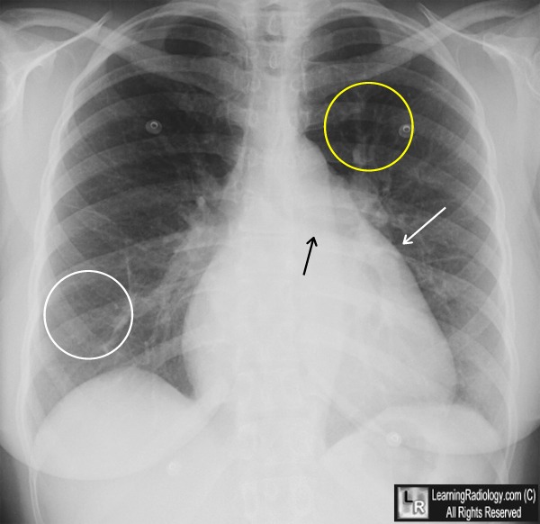 LearningRadiology